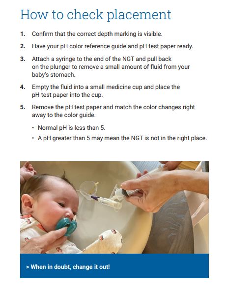 A page in the educational pamphlet instructing parents on placing the NGT tube, featuring Anna Sofia.