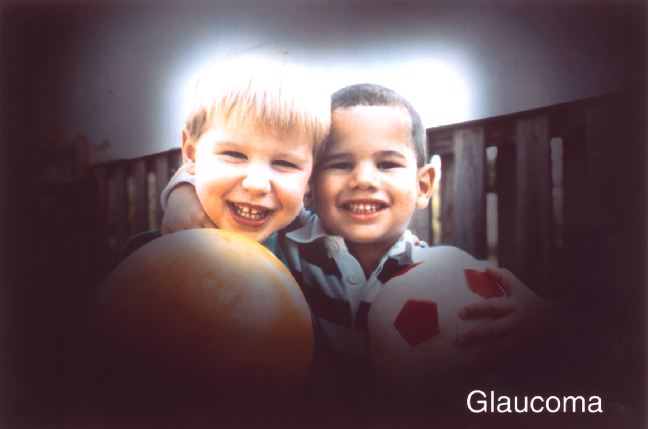 photo representation of vision loss people with glaucoma might experience, depicting two small children smiling surrounded by darkness, representative of visual field loss.